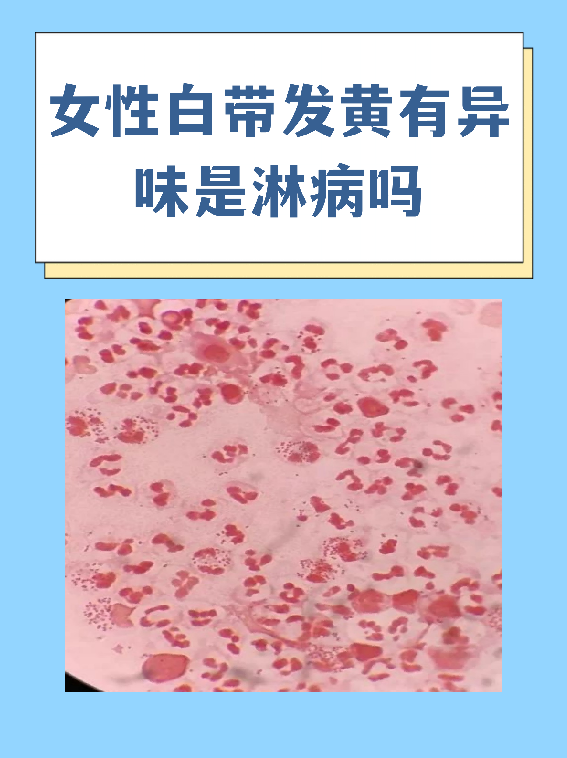 “保定:感染者确实不少” 保定感染病例？