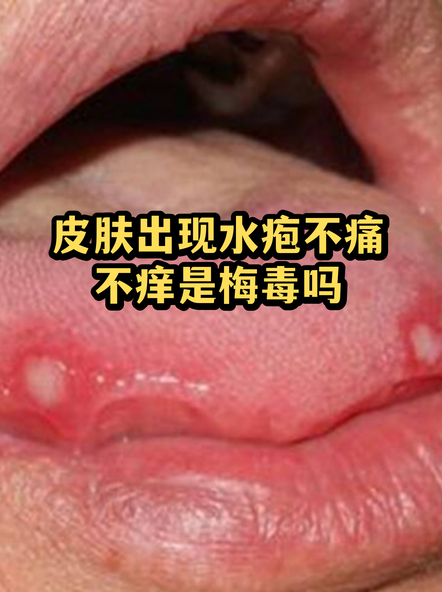 “保定:感染者确实不少” 保定感染病例？-第2张图片