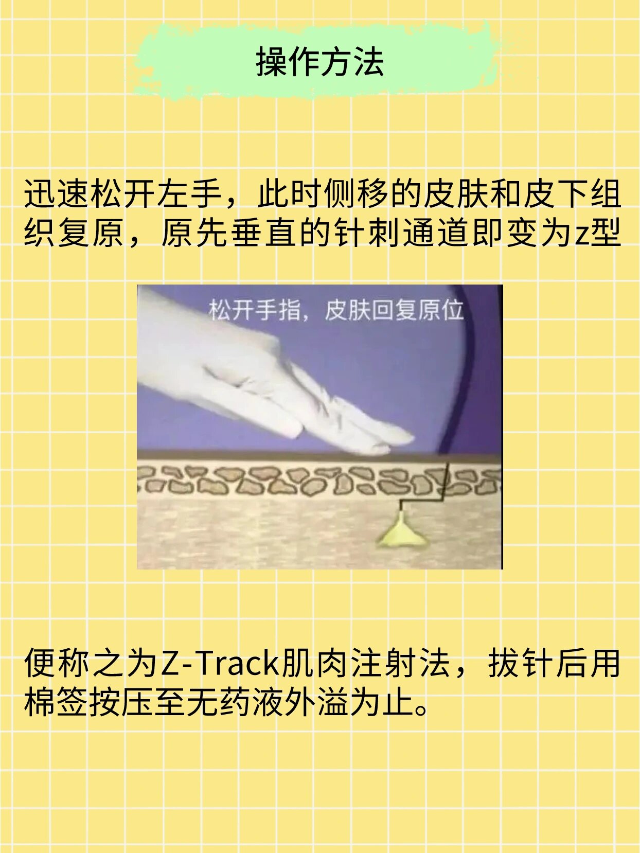 3分钟学会“人皇大厅透视挂	”开挂(透视)辅助教程-第2张图片