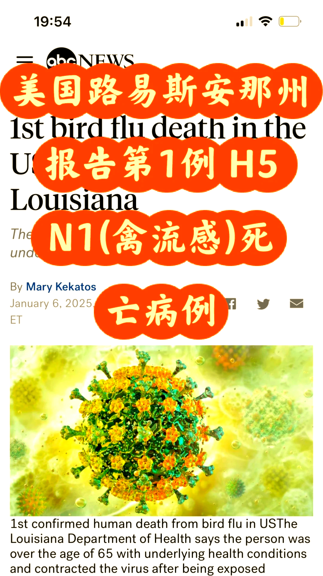 “美国新冠病毒感染病例超过45万	” 美国新冠感染数？-第2张图片