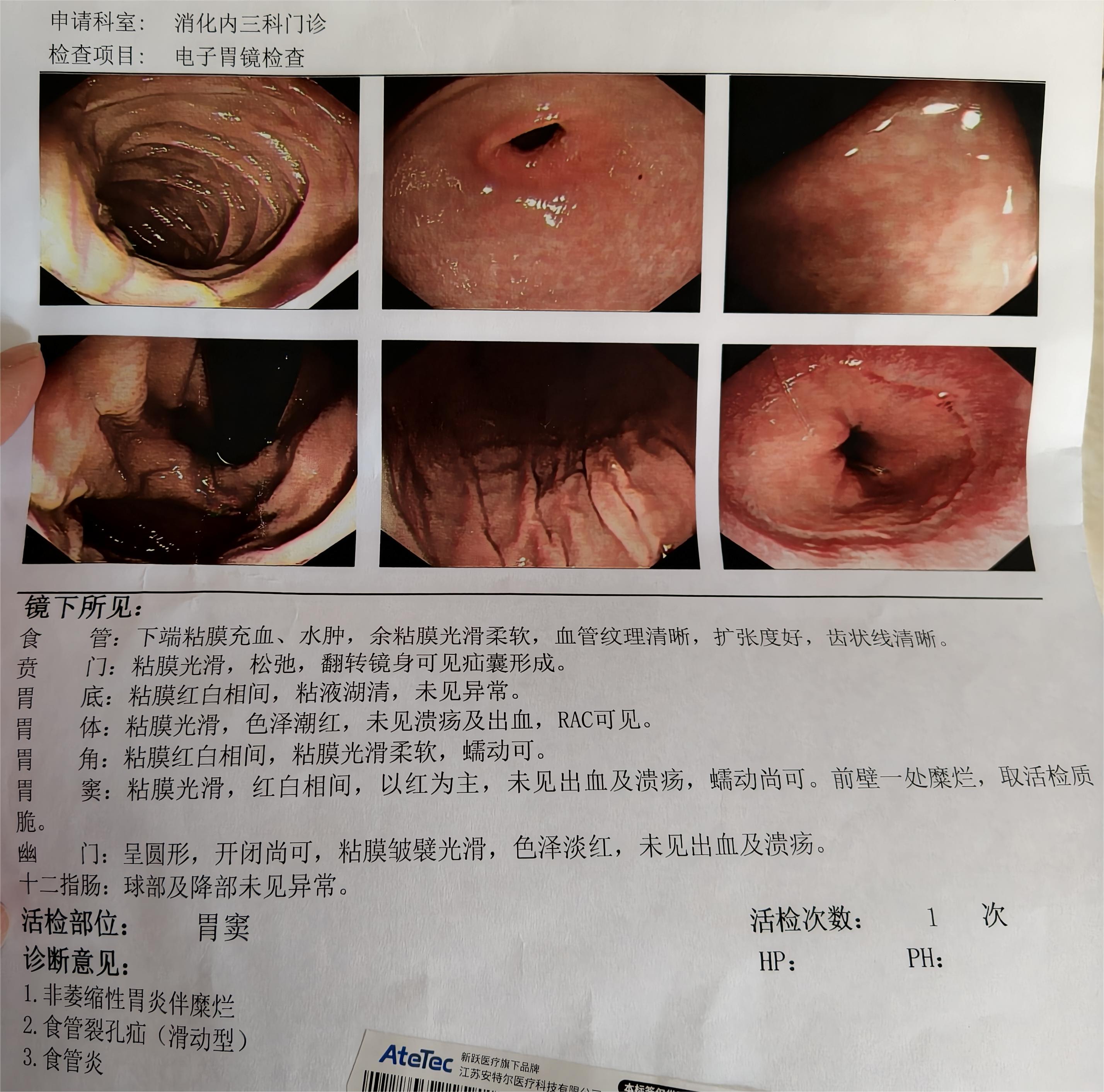31个省新增46例确诊病例︰(31个省新增46例确诊病例是哪里的)-第2张图片