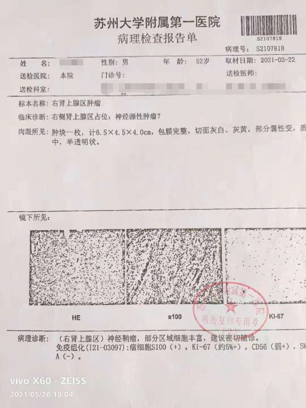 山东最新疫情报告〃山东最新疫情报告数据-第2张图片
